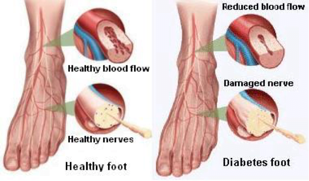 healthy feet